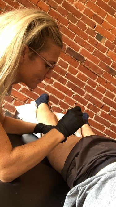 physical therapy performing dry needling on a patient's thigh