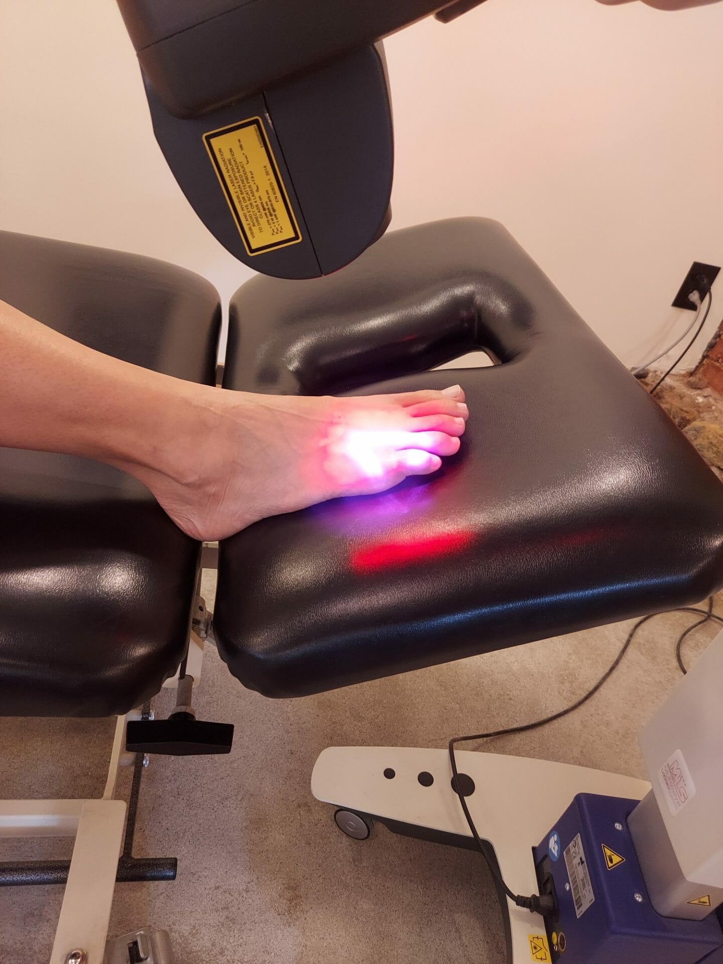 laser therapy